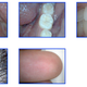 Illustration for article titled Thankos USB Mouth Microscope Camera Shows You The Horrible Truth